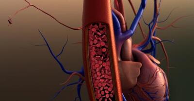 Circulation Symptoms - Symptoms, Causes, Treatments